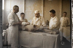 France, Moreuil, Hôpital d'évacuation de Moreuil. Blessures produites par les éclats d'obus