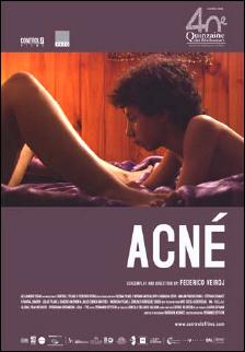 Carátula de la película Acné